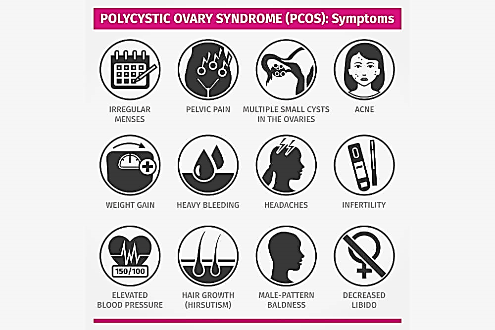 PCOS symptoms