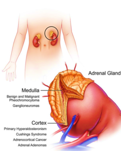 disorders of adrenal gland